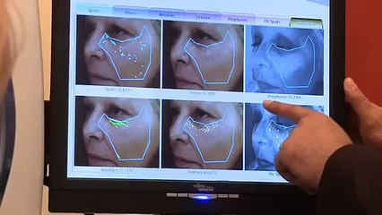 Save BIG on Botox Treatment | Special Offer at Harley Street Skin Clinic