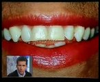 Clínica dental Cuevas Queipo - Estetica y cerámicas