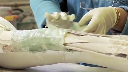 Il fait un travail plus que magnifique avec ces infirmes.