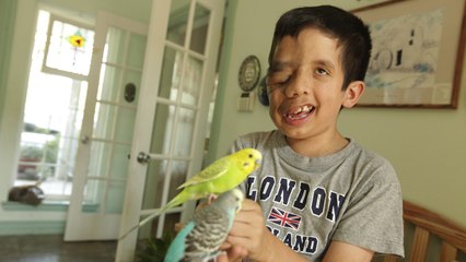 Boy Rejects Tumour Surgery To Save His Smile