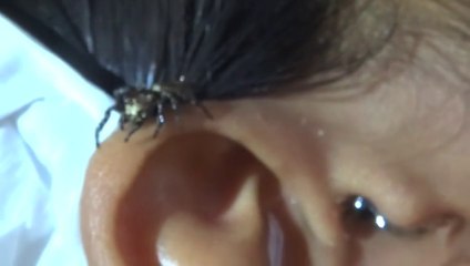 Il déloge une Araignée de son Oreille avec quelques gouttes