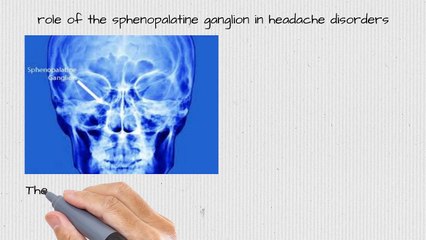 Relieve your Headache with Laser aimed at Painful Nerves- Norwalk, Greenwich