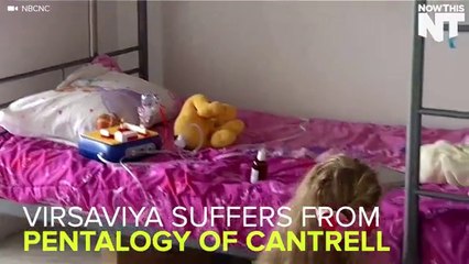 Little Girl Born With Rare Condition Has Her Heart On The Outside