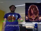 mirracle: An Augmented Reality Magic Mirror System for Anatomy Education