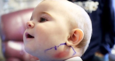 Nevjerovatan slučaj: Pero u bebinom vratu