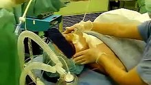 ﾁｭｰﾌﾞｴｸｽﾁｪﾝｼﾞｬｰ を留置したまま 抜管 tube exchanger