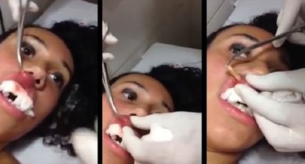 Une larve dans la lèvre