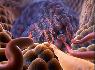 Pediatric Orthopedics: Osteomyelitis in Children