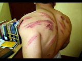 بعض طرق التعذيب الوحشية في السجون السورية
