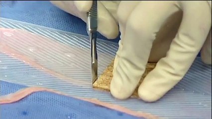 The Humeca D42 and D80 battery operated cordless dermatomes