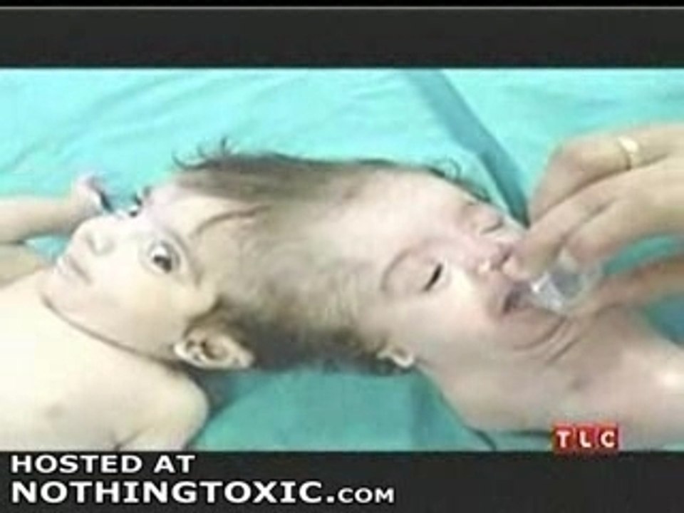 Media_cd08e74bf7c9428fc_1176288580