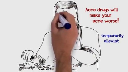 Acne Treatment Home Remedies