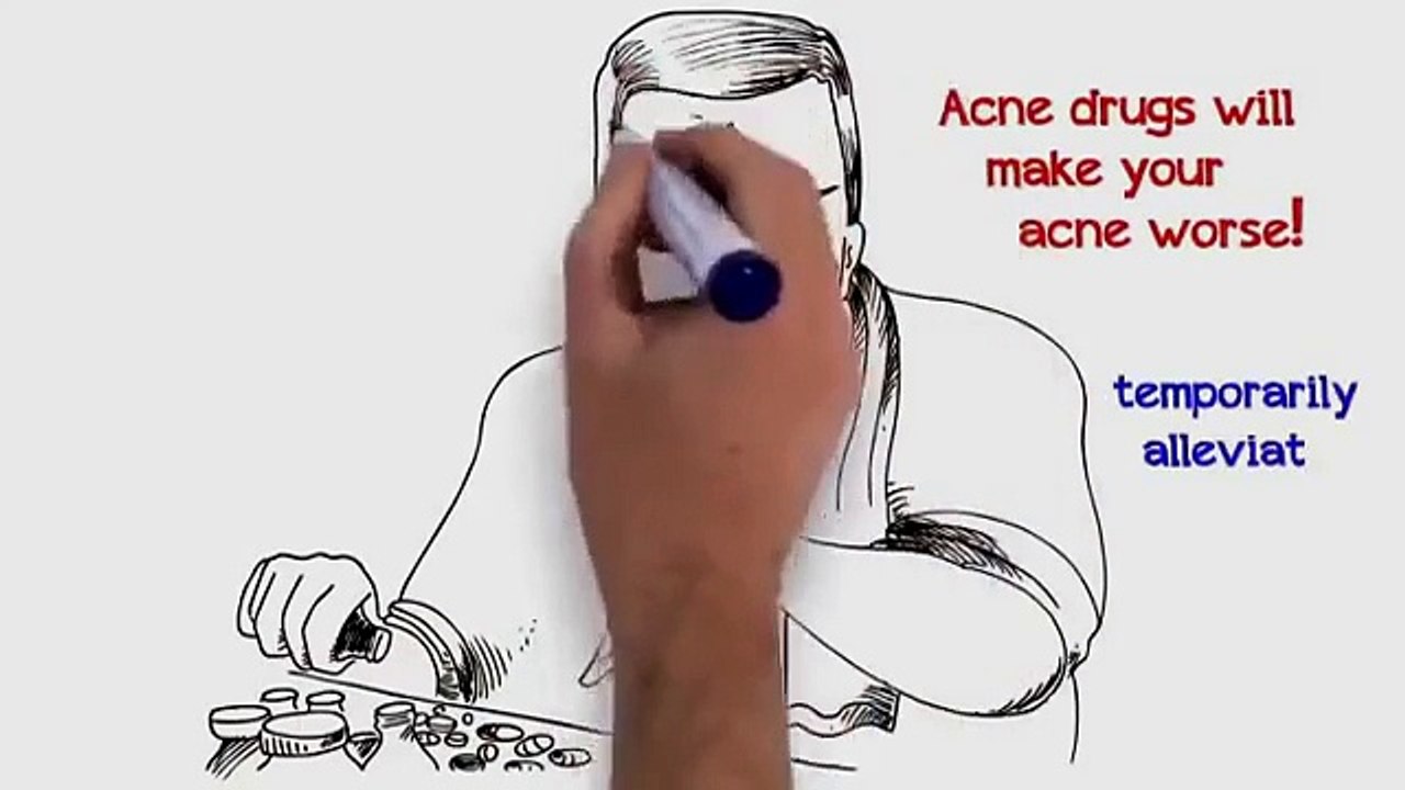 Acne Treatment Home Remedies