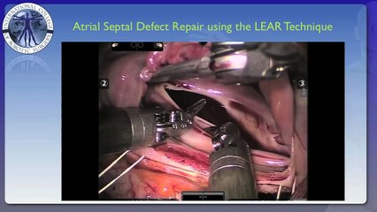 Heart Surgery Through Tiny Holes