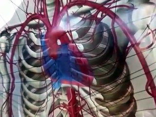 Dr Paul Kangas, ND, on strokes