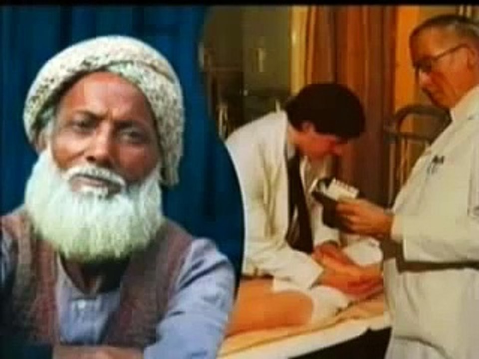 Circumcision using the SMART KLAMP