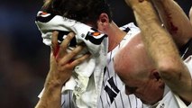 Yanks Pitcher Hit in Face by Line Drive
