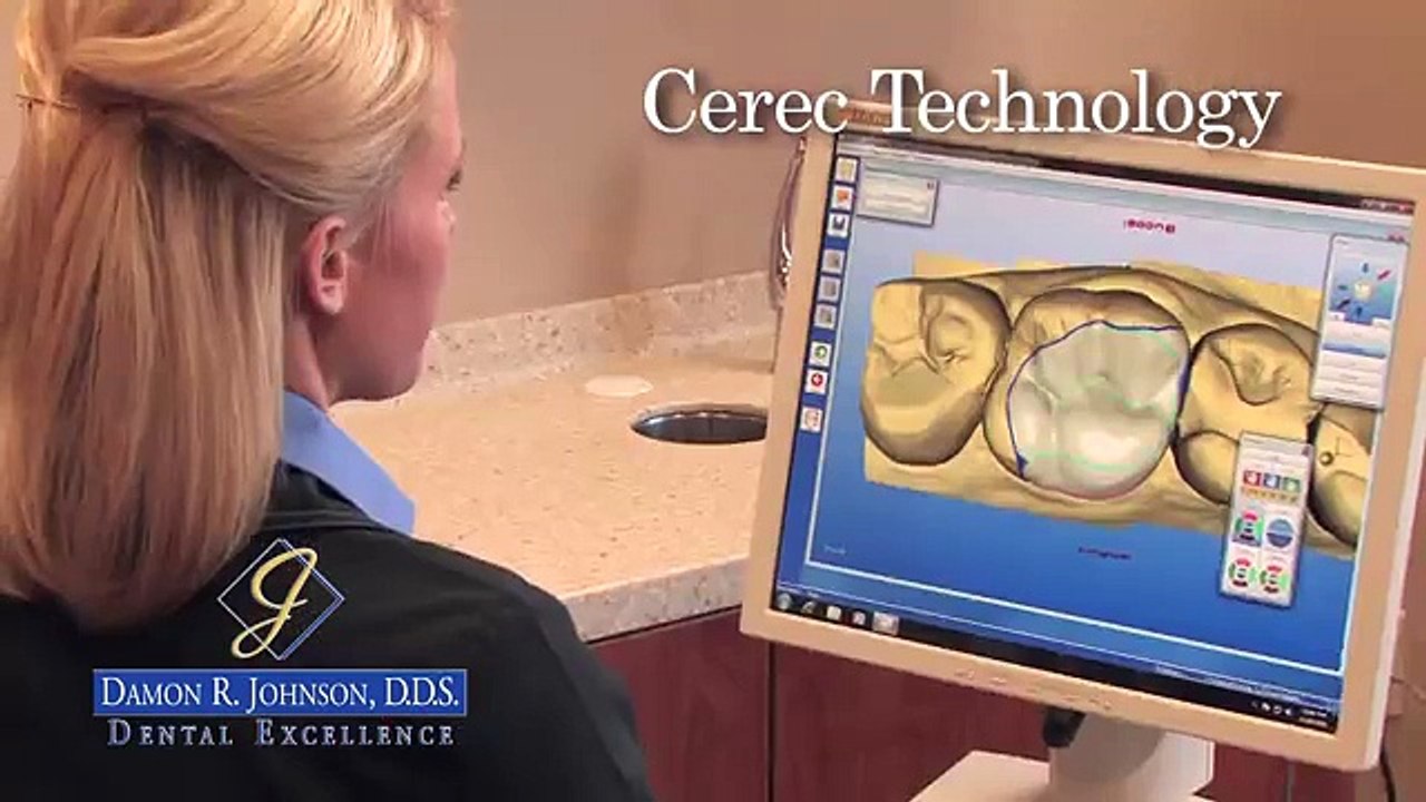 Damon R. Johnson, DDS | Cerec Crowns -  Edmond OK Dentist - Edmond Dentist