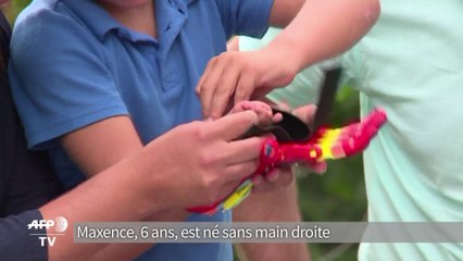 Impression 3D: donner une main aux enfants qui n'en ont pas