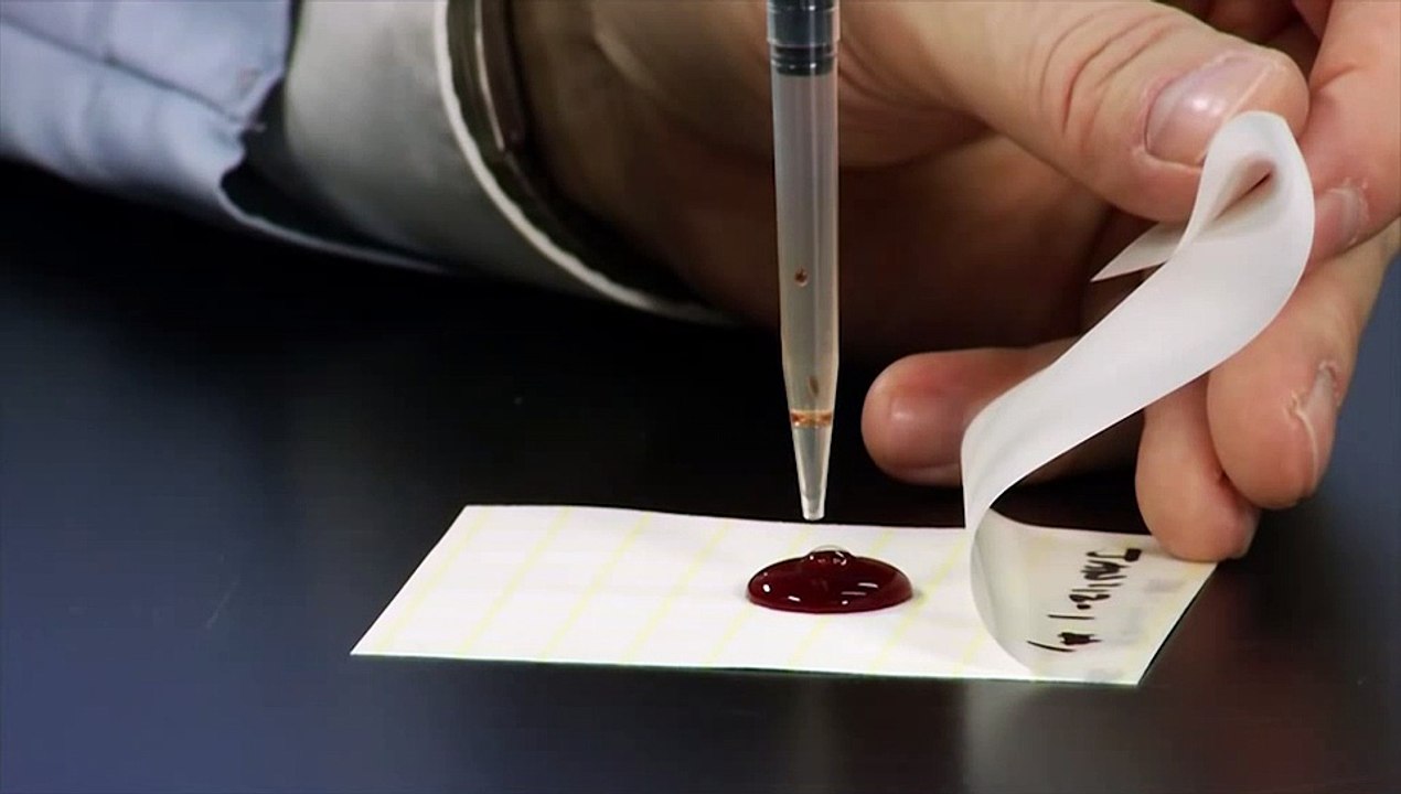 3M™ Petrifilm™ Plates - Lactic Acid Bacteria