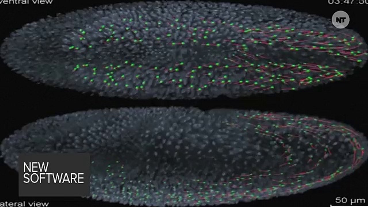 This Technology Helps Scientists Watch Brains Develop