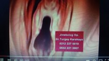 Kızlık Zarı Ameliyatı İstanbul - Jinekolog Op Dr Turgay Karakaya