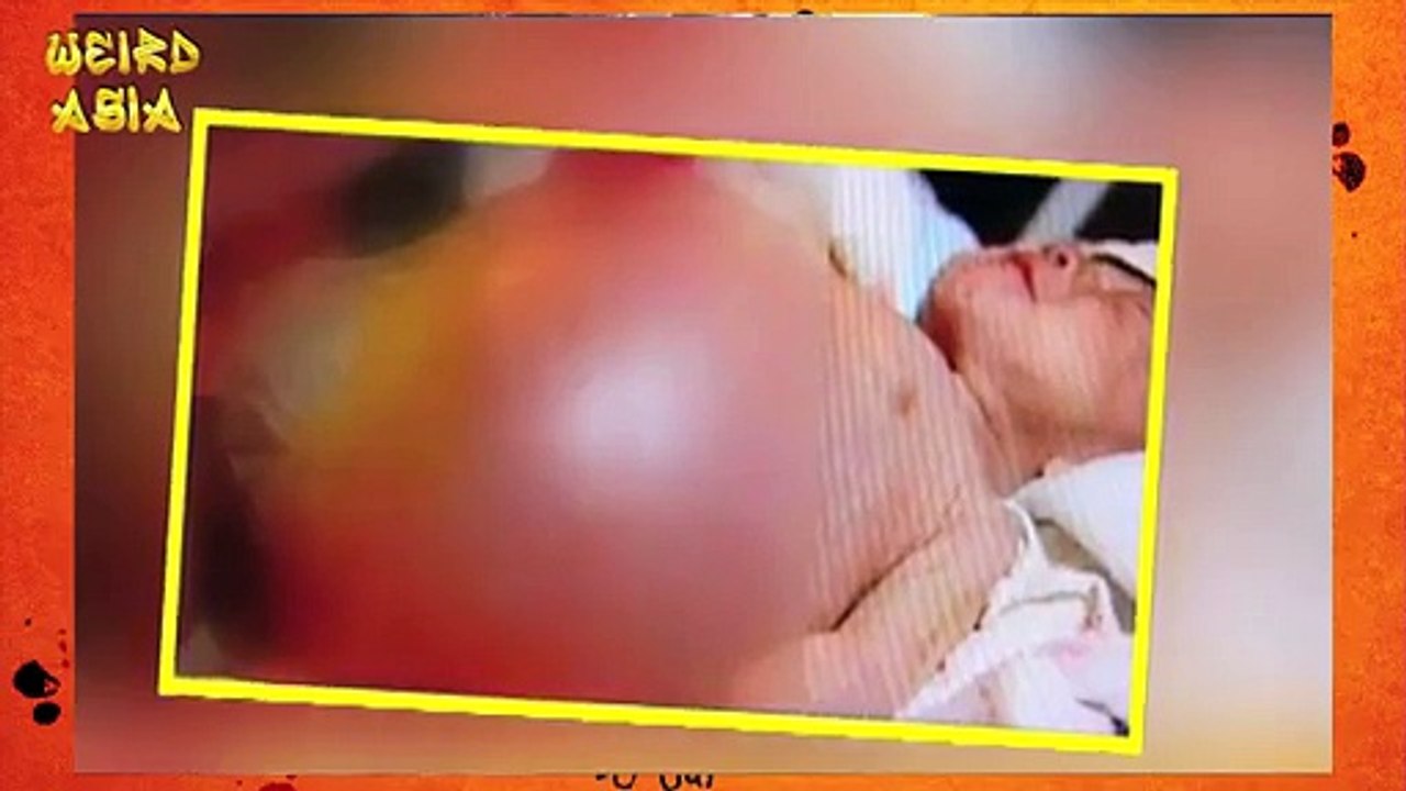 2 Year Old Gives Birth to Own Twin