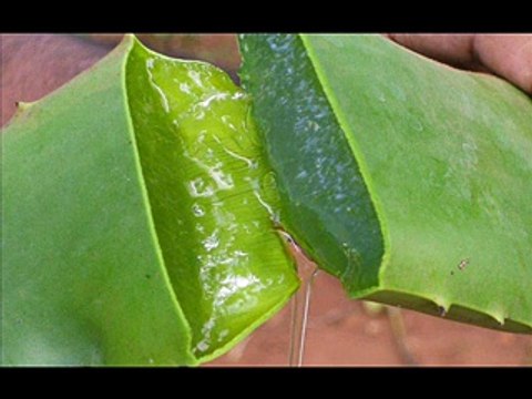 Natural Treatments and Remedies for Oily Skin - Video Dailymotion