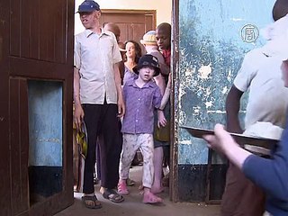 Африканские предрассудки: есть ли шанс у альбиносов?