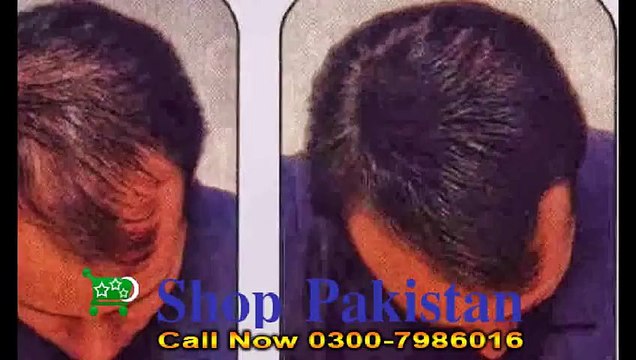 Hair Building Fiber in Pakistan Call Now 0300-7986016