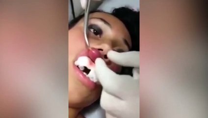 Moment larvae is removed from girl's lip(Video)