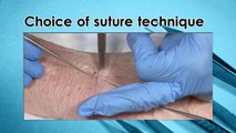 How to suture  - part 2: Simple sutures and mattress sutures