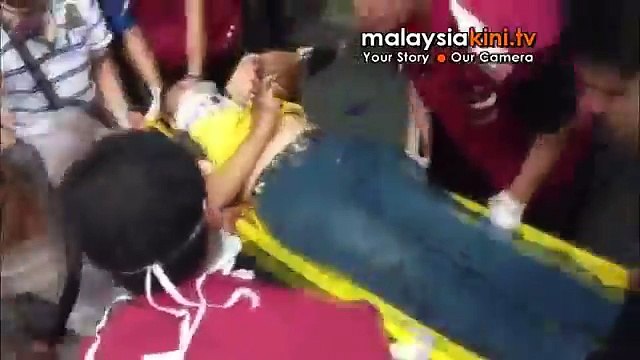 Bersih 3.0: Injured protester at SoGo