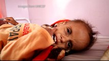 Yemen conflict: over a thousand child casualties so far