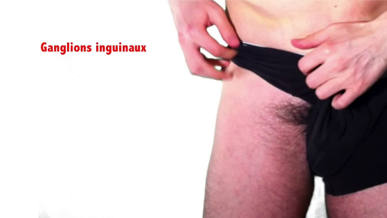 Ganlions lymphatiques inguinaux - Comment examiner les aires ganglionnaires inguinales (tutoriel)