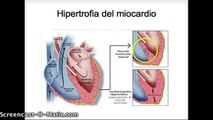 Adaptaciones cardiovasculares al entrenamiento