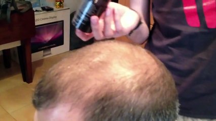 CABOKI | Crece-pelo IMPRESIONANTE,funciona de verdad VER PARA CREER | elPutoChiCho