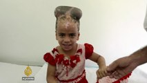 The Cure - Solar-Powered Hearing Aids in Brazil & Jordan’s Rehabilitation Clinic for Victims of War