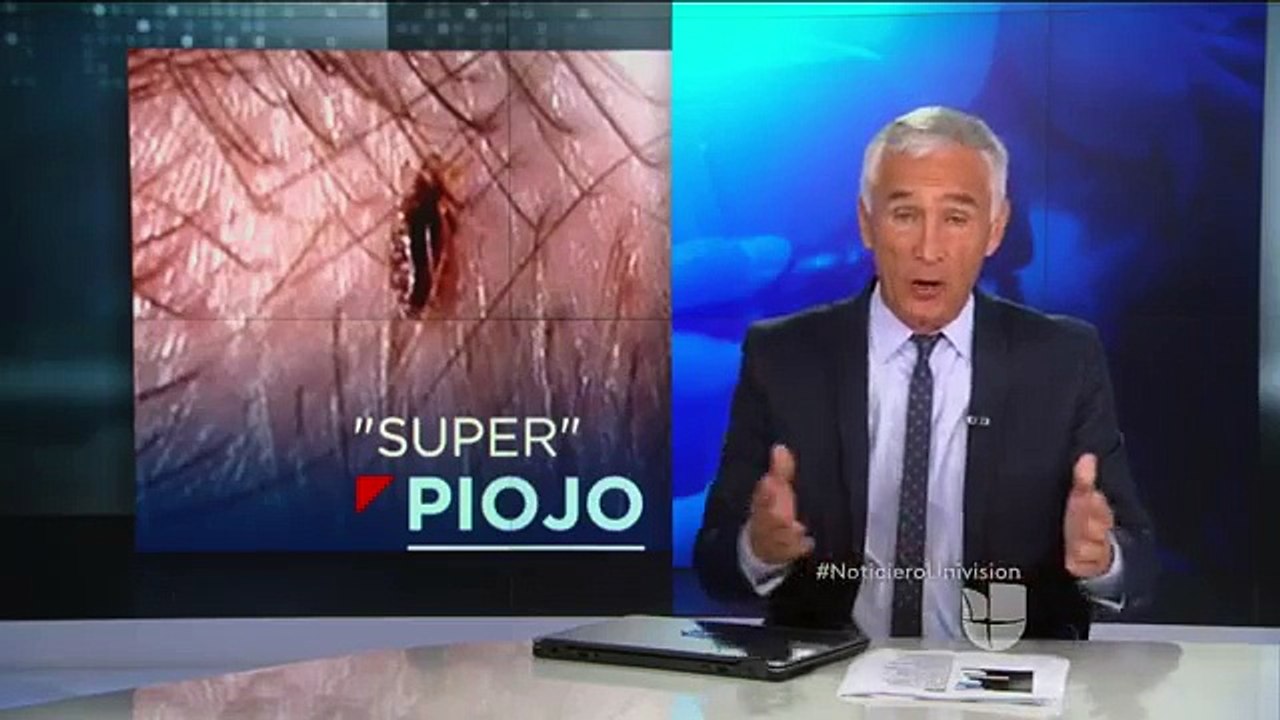 Expertos aseguran que los piojos se han vuelto inmunes a tratamientos médicos