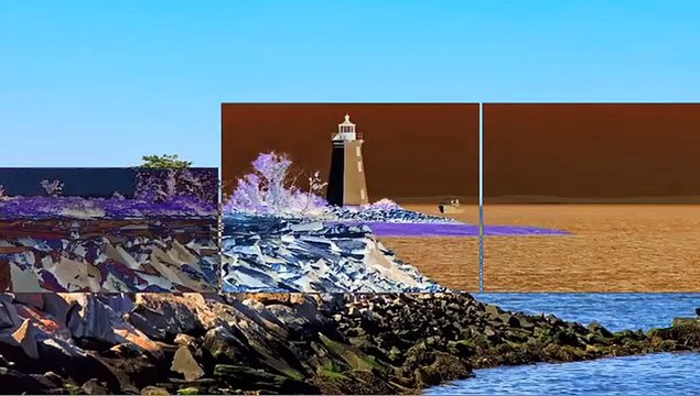 Implant Restoration - Bridgeport, CT - DeJesus Dental Group