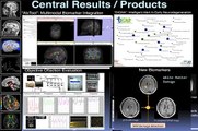 MRI biomarkers in neurodegenerative diseases and neurological disorders - Juan Antonio Hernandez