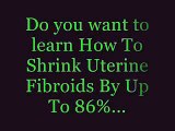 fibroid breast tumors