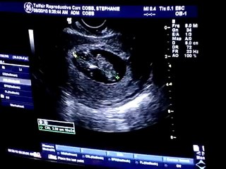 Baby Cobb 10 weeks Ultrasound Heartbeat!!