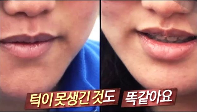 렛미인 시즌5 12회 쌍둥이자매 150821 FULL HDTV 렛미인 시즌5 12화 MNMKSDT E12