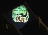 Augmented Reality Brain Slicer (Interactive Flexible Display Surface)