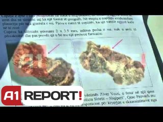 21 janari, eksperti: Ziver Veizi u vra nga plumb i drejtëpërdrejtë