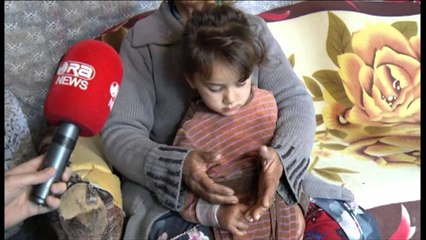 Dita botërore, romët sërish probleme me punën dhe banesat