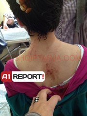 A1 Report / Denoncimi për dhunë mbi vajzën autike, hetimet e policisë