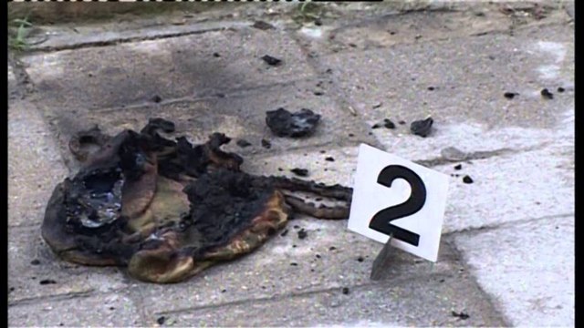 Durrës, vetdigjet një 50 vjeçar. Shkak për çështje pronësie, Ashim Shemsi dërgohet në spital