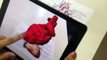 3D Model of Heart- Augmented Reality Example for Healthcare and Medical Education